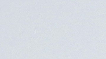 Síndrome de Cushing: de qué trata la enfermedad de la actriz Amy Schumer