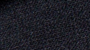 Remedios caseros para eliminar las estrías.