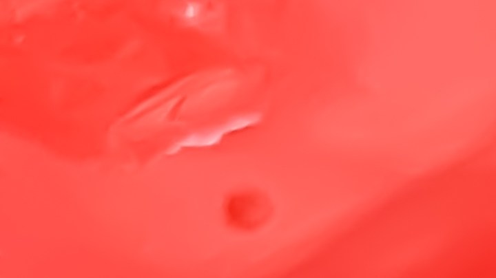 4 enfermedades que producen las moscas y cómo evitarlas