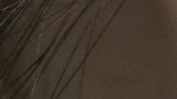 La razón inesperada por la que puedes sufrir de herpes labial.