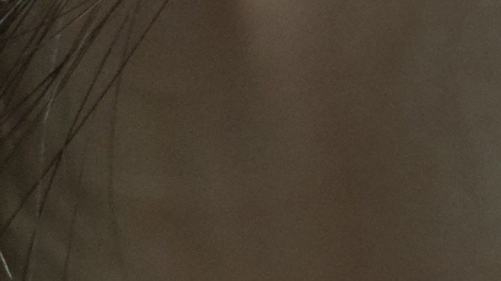 La razón inesperada por la que puedes sufrir de herpes labial.