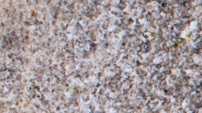 Qué alimentos te ofrecen más potasio.