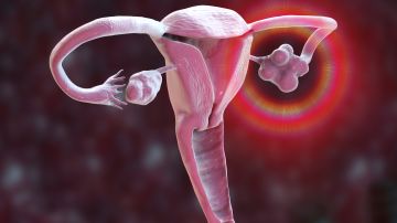 Los ovarios políquísticos estarían relacionados con el deterioro cognitivo