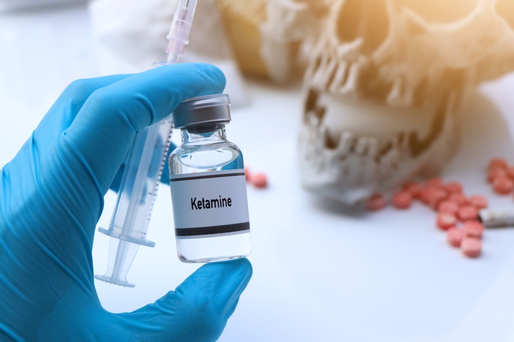 Expertos revelan efectos de la infusión de Ketamina para la salud mental