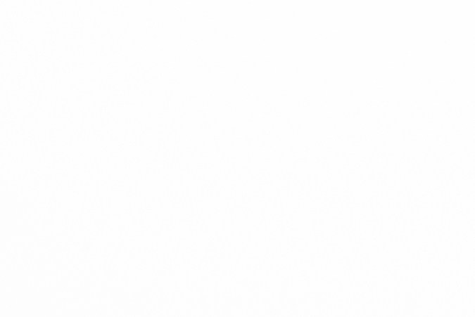 Lipedema: La enfermedad que se confunde con obesidad, pero no tiene cura