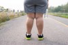 Lipedema: La enfermedad que se confunde con obesidad, pero no tiene cura