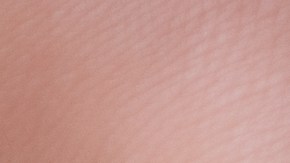 Precauciones a tener en cuenta para relaciones sexuales post cesárea