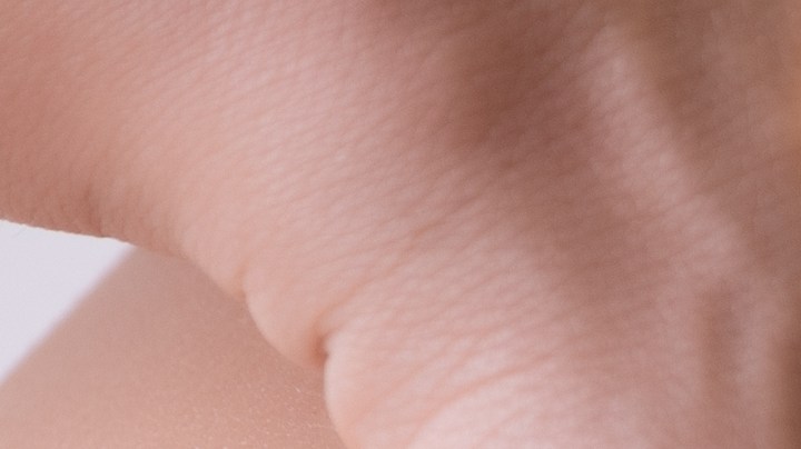 Precauciones a tener en cuenta para relaciones sexuales post cesárea