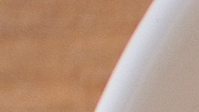 Si bien los plátanos son aliados para controlar la hipertensión, los expertos aclaran no son un sustituto del tratamiento médico que estés siguiendo.