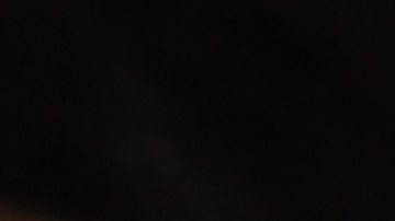 Los chupetones aparecen después de una succión o un mordisco, siendo de color marrón, rojo o azulado.