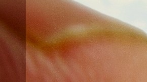 Hay quienes creen que el efecto mentolado del mentol es una especie de "curación", por lo que le dan usos inéditos al Vicks Vaporub.