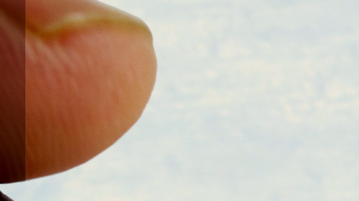 Hay quienes creen que el efecto mentolado del mentol es una especie de "curación", por lo que le dan usos inéditos al Vicks Vaporub.