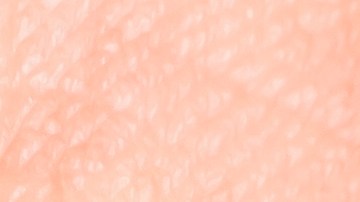 5 Anomalías en las uñas que significan una afección de salud