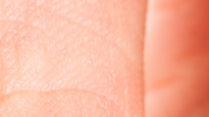 5 Anomalías en las uñas que significan una afección de salud