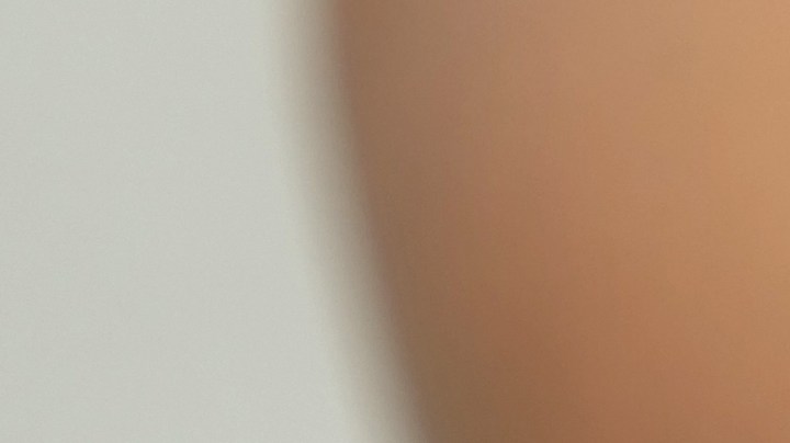 Artritis reumatoide: Causas, síntomas y tratamiento preventivo