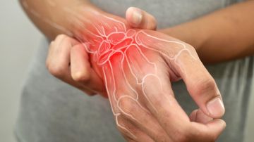 Artritis reumatoide: Causas, síntomas y tratamiento preventivo