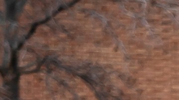 La FDA reportó más de 270 lesiones graves por el uso de dispositivos para la insuficiencia cardiaca.