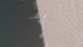 Un analgésico tópico a base de lidocaína, que se aplica correctamente, puede controlar, aliviar o prevenir el dolor, según Mayo Clinic.