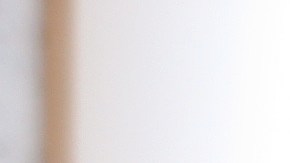 5 Consejos para tratar las hemorroides en casa