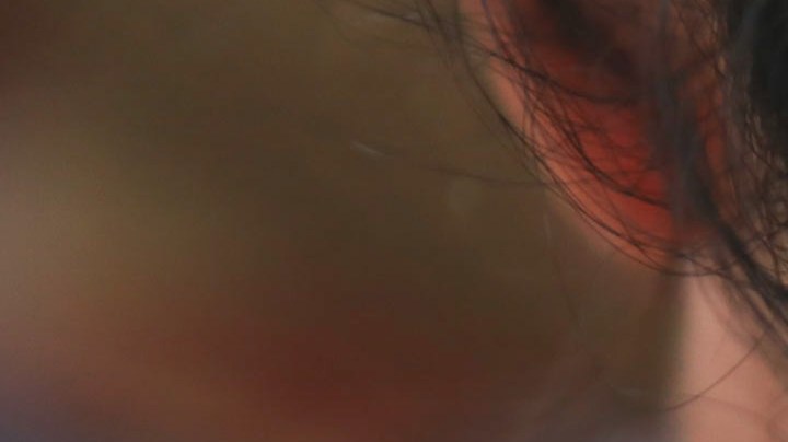 El lupus puede estar dormido años, pero es una enfermedad para toda la vida