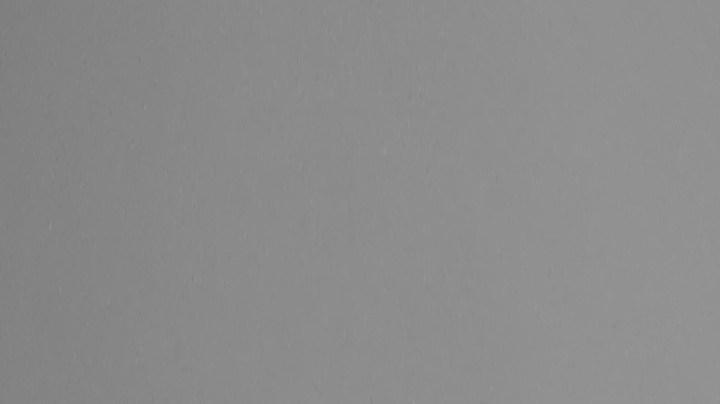 Qué es el mewing y cómo funciona para embellecer los rasgos faciales