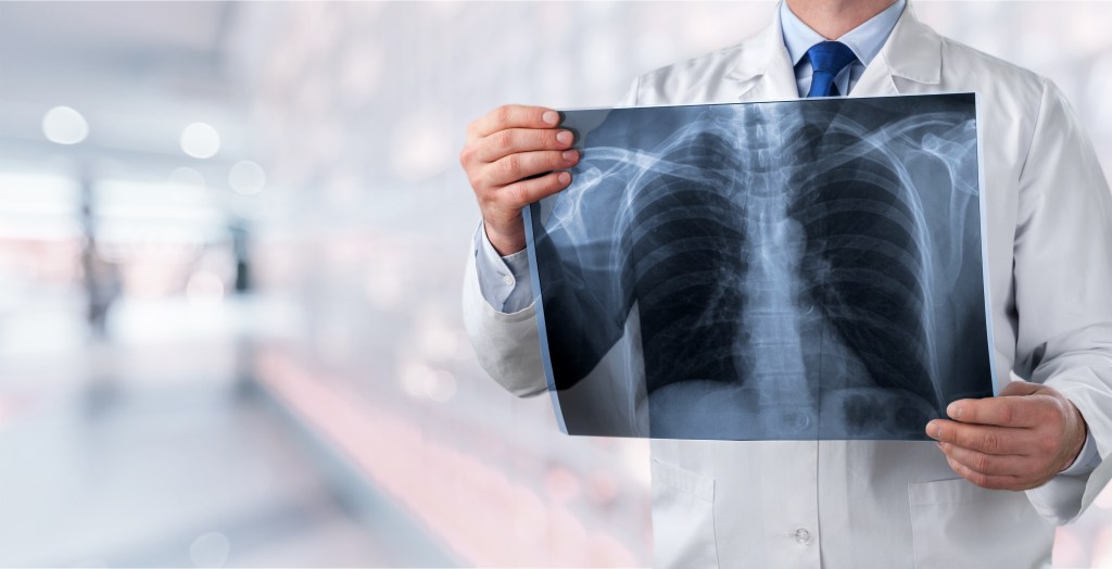 8 daños en los pulmones a causa del asma, según científicos