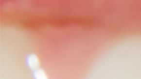 Las caries aparecen cuando has permitido que ciertas bacterias ingresen a tu boca y causen daños que dejan manchas y heridas.