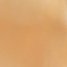 Los expertos señalan que si alguno de los miembros del hogar sufre una picadura de abeja, el significado es que algo va a suceder en casa.