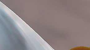 Antes de iniciar cualquier tratamiento, es importante que te sometas a pruebas de laboratorio para identificar el tipo de bacteria y cuán resistente puede ser.