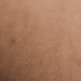 En el lado derecho del cuerpo hay varios órganos que pueden causar dolores: pulmones, vesícula biliar, páncreas, apéndice, colon y riñones.