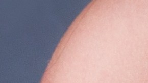 Las mujeres de senos voluminosos o grandes son más propensas a la aparición de estrías en esta zona de la piel.