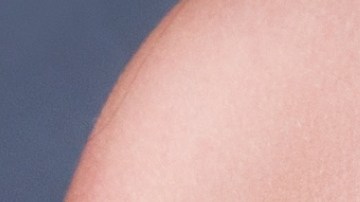 Las mujeres de senos voluminosos o grandes son más propensas a la aparición de estrías en esta zona de la piel.