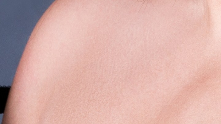 Las mujeres de senos voluminosos o grandes son más propensas a la aparición de estrías en esta zona de la piel.