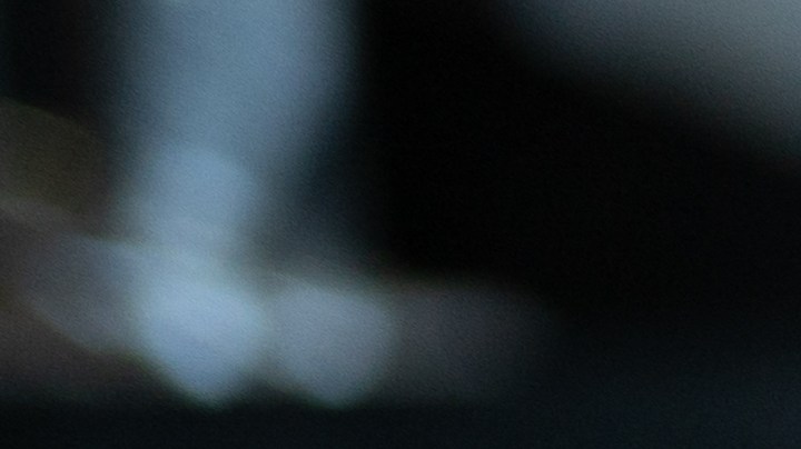 Cuando se produce una irritación y no se trata a tiempo, tus muslos comienzan a enrojecerse y brotarse, provocando una comezón que rompe la piel.