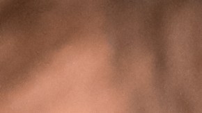 Cuando el agua permanece mucho tiempo en el oído, podrías desencadenarte una infección llamada "otitis media o externa".