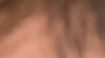 Cuando el agua permanece mucho tiempo en el oído, podrías desencadenarte una infección llamada "otitis media o externa".