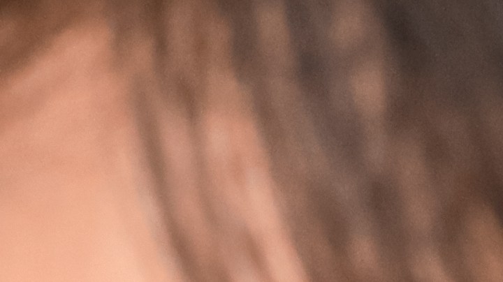 Cuando el agua permanece mucho tiempo en el oído, podrías desencadenarte una infección llamada "otitis media o externa".