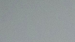 Los gatos son propensos a infectarse del Toxoplasma gondii, un parásito que puede infiltrarse en tu sistema nervioso central.