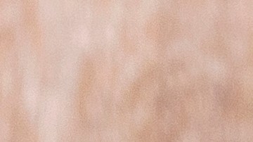 La avena suele ser recomendada como remedio casero para calmar manifestaciones de la piel, como prurito, sarpullido y otras reacciones.