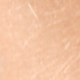 Ante algún olor extraño, tu primer paso es hacerte un control ginecológico para descartar cualquier afección vaginal.