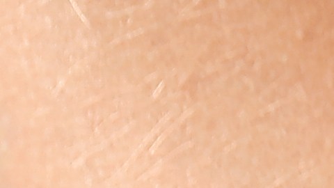 Ante algún olor extraño, tu primer paso es hacerte un control ginecológico para descartar cualquier afección vaginal.