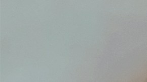 Es importante que nunca te maltrates el rostro con las manos ni permitas que el acné avance, porque podría dejarte marcas difíciles de eliminar.