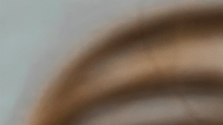 Es importante que nunca te maltrates el rostro con las manos ni permitas que el acné avance, porque podría dejarte marcas difíciles de eliminar.