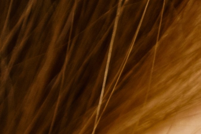 Acude con un especialista para que determine el tratamiento adecuado para tu acné.