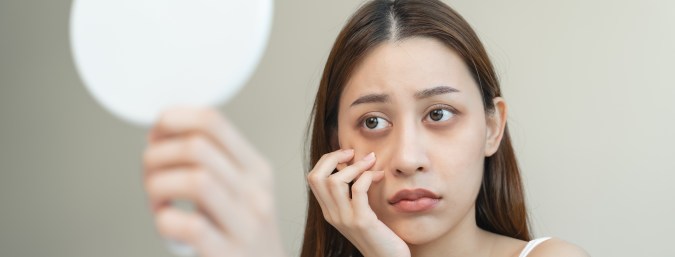 Las ojeras oscuras suelen aparecer por el cansancio, la falta de sueño o malos hábitos.