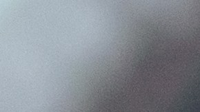 El Dermapen es el tratamiento ideal para combatir arrugas y líneas de expresión.