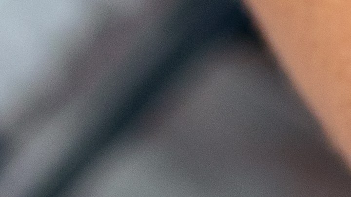 El Dermapen es el tratamiento ideal para combatir arrugas y líneas de expresión.