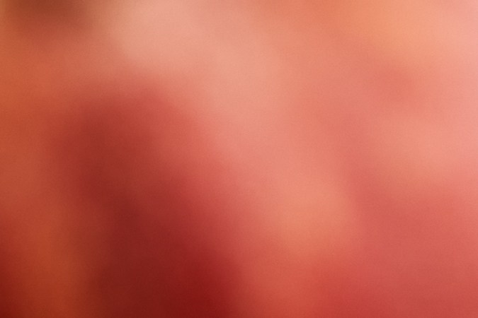 Debes diluir el vinagre de manzana antes de aplicarlo en el cuero cabelludo.