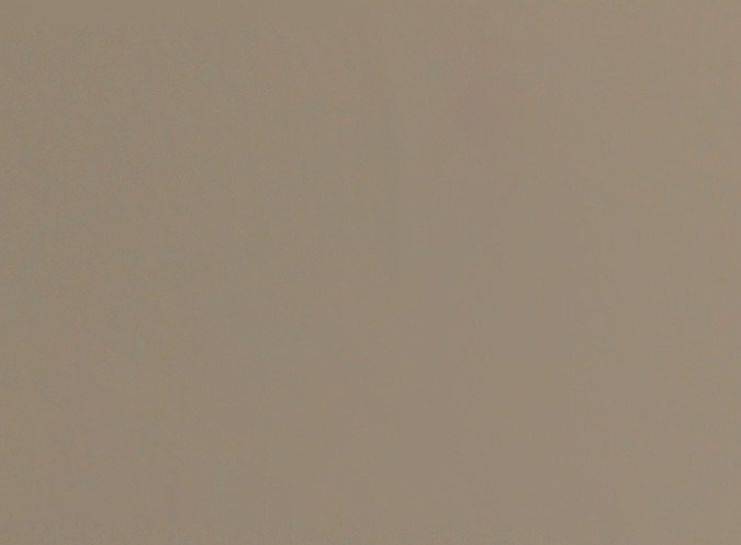 El deterioro cognitivo afecta la función cerebral.