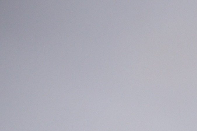 Desarrolla un estilo de vida saludable para reducir la aparición de celulitis.